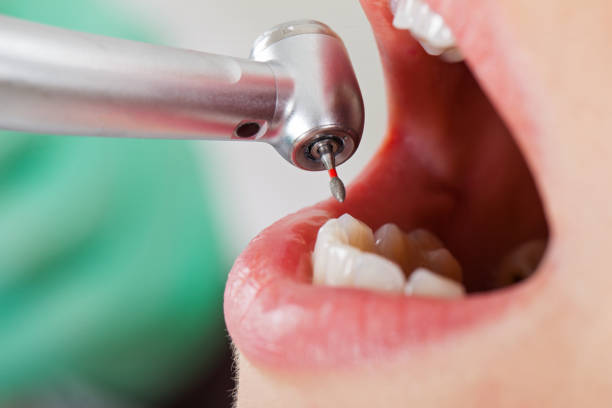 Best Emergency Orthodontic Repairs in Crosby, TX